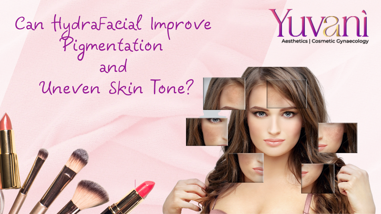 Can HydraFacial Improve Pigmentation and Uneven Skin Tone?