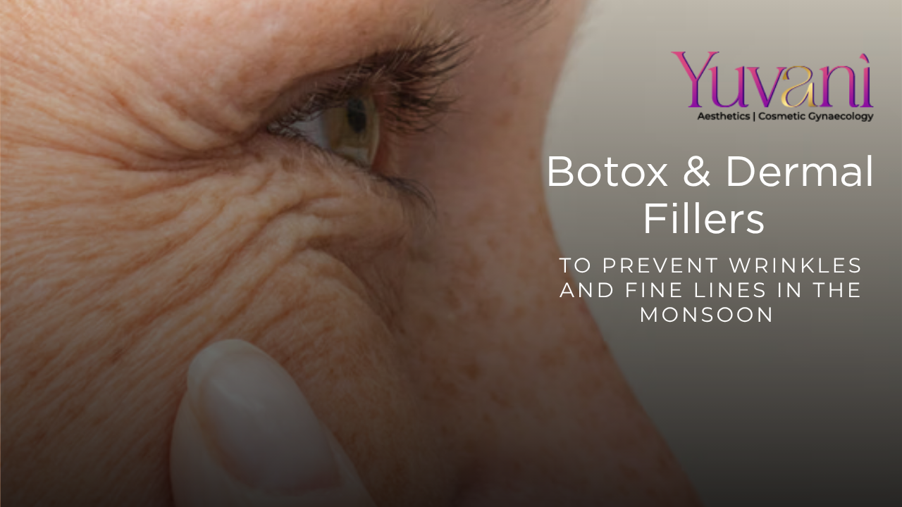 How to Prevent Wrinkles and Fine Lines in the Monsoon with Botox and Dermal Fillers