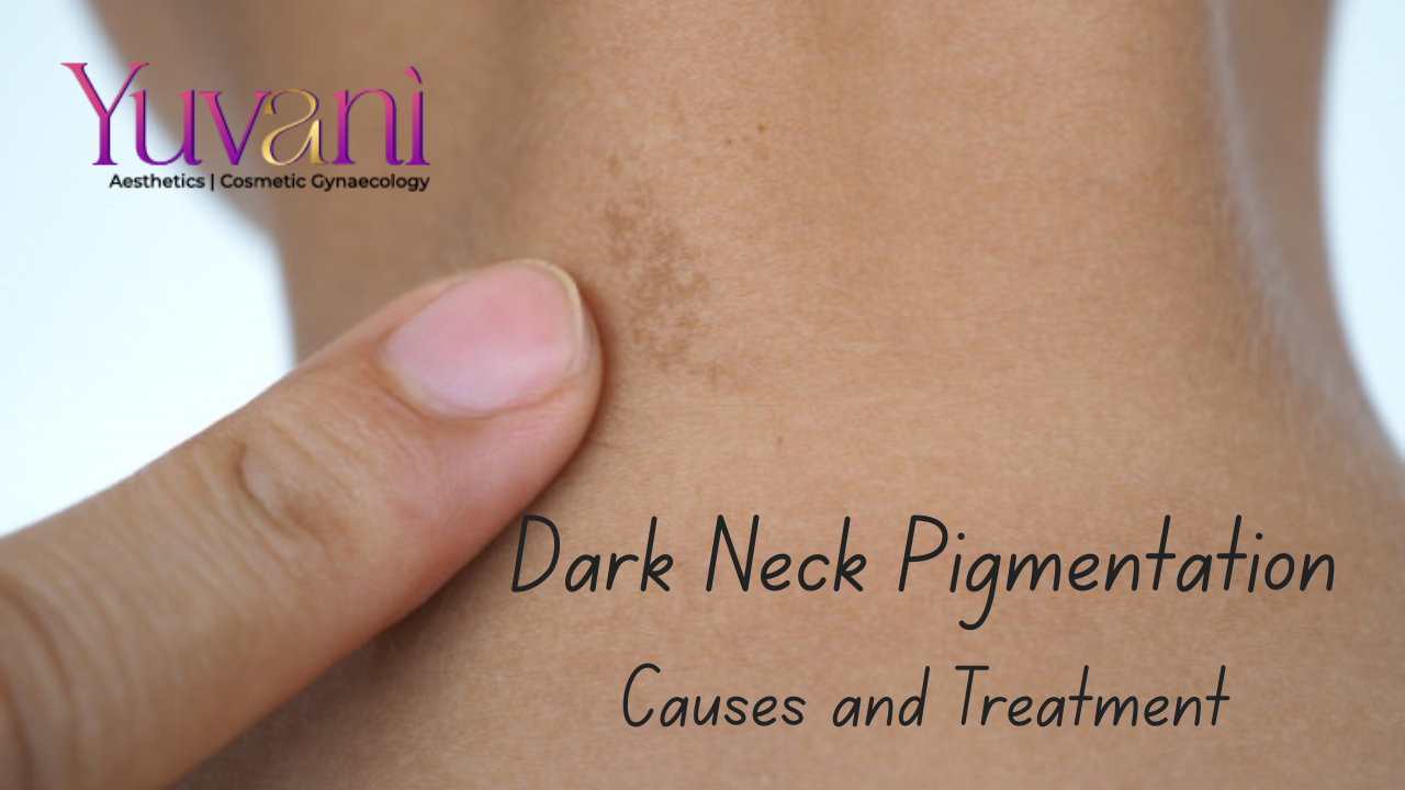 Dark Neck Pigmentation: Causes and Treatment