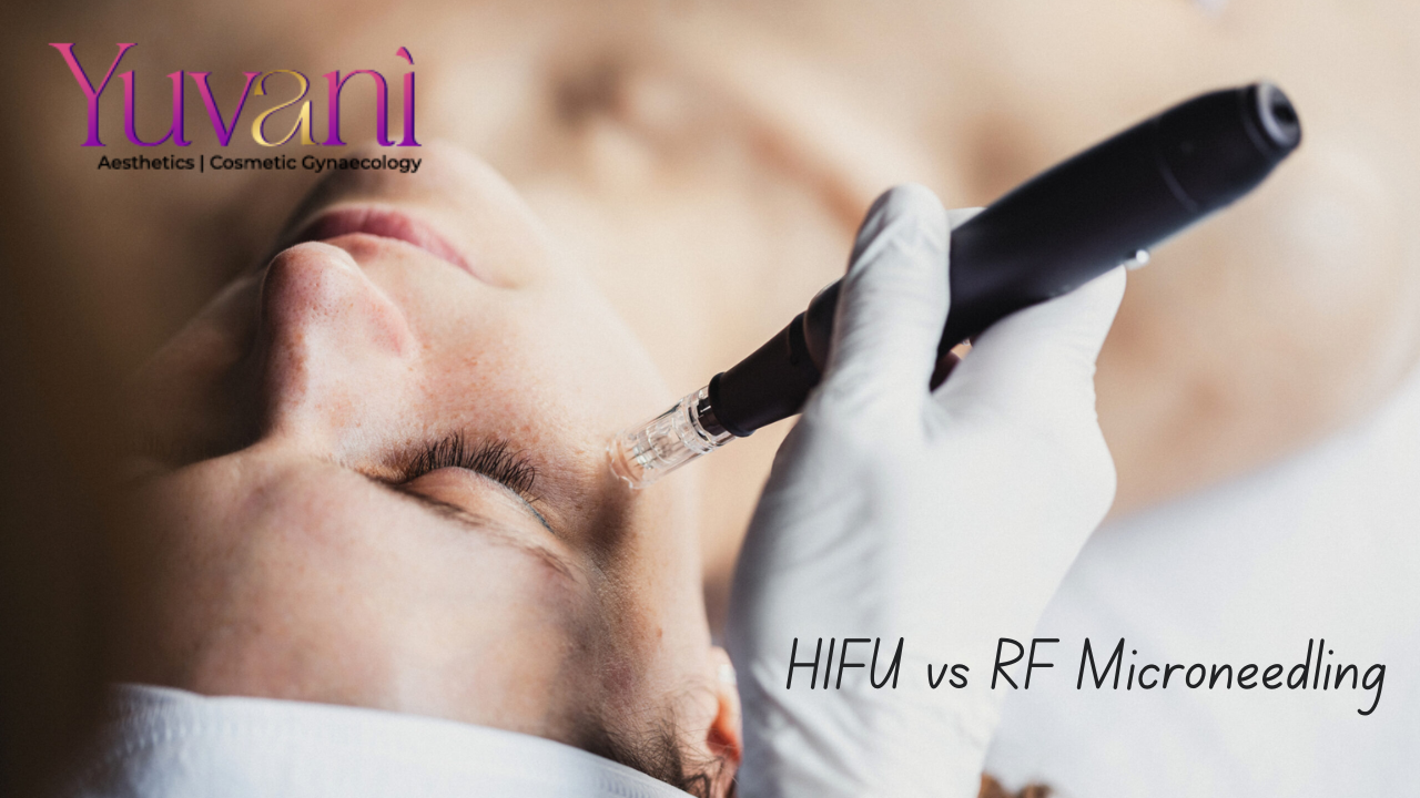 HIFU vs RF Microneedling: Which Is Better? | Navi Mumbai
