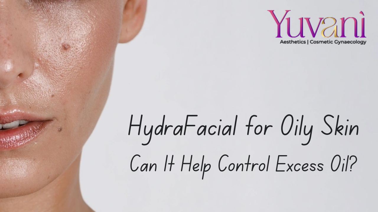 HydraFacial for Oily Skin: Can It Control Excess Oil?