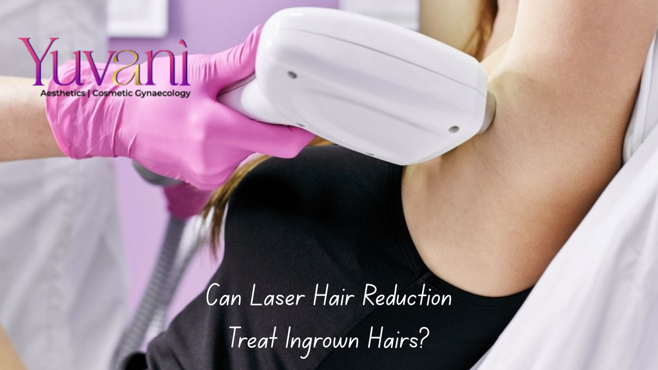 Laser Hair Reduction for Ingrown Hairs | Navi Mumbai