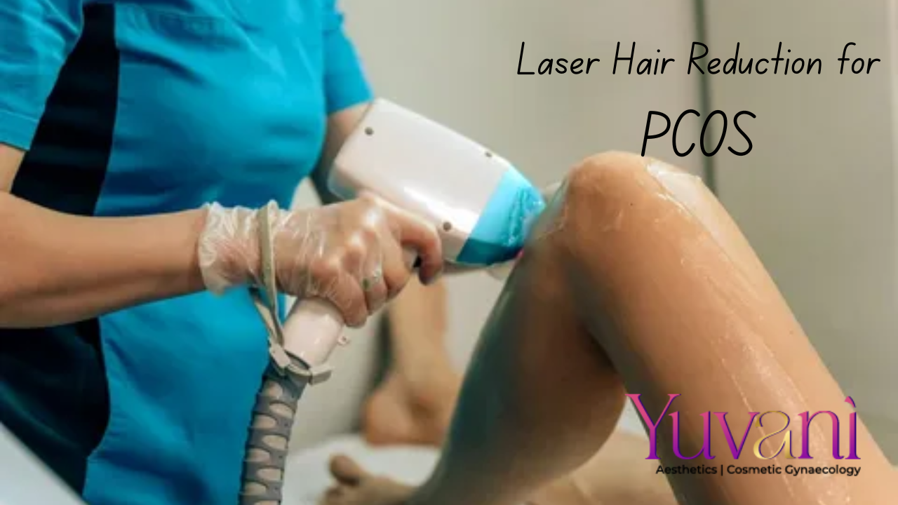 Laser Hair Reduction for PCOS | Laser Hair Reduction in Navi Mumbai