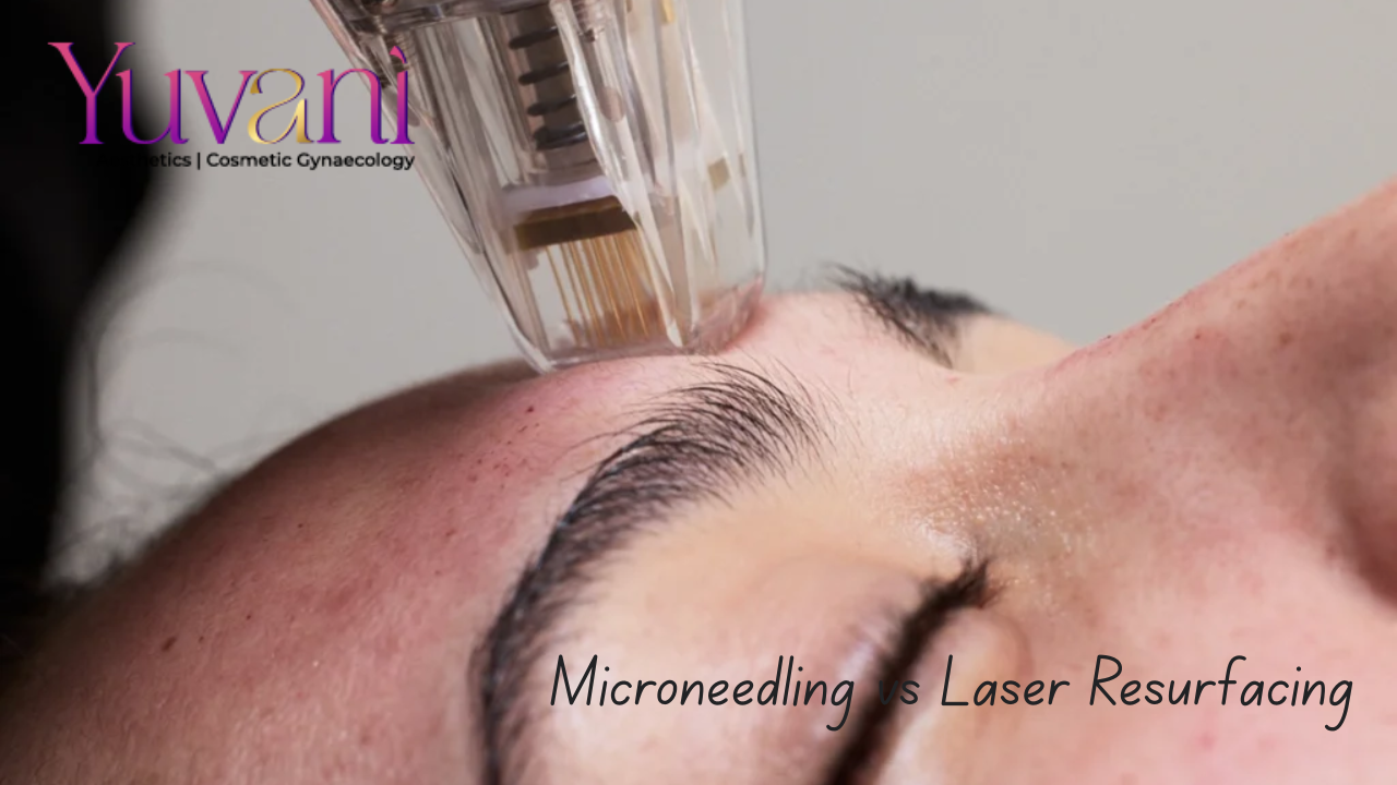 Microneedling vs Laser Resurfacing | Which Is Better? Navi Mumbai
