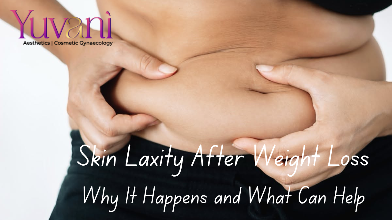 Skin Laxity After Weight Loss: Why It Happens and What Can Help