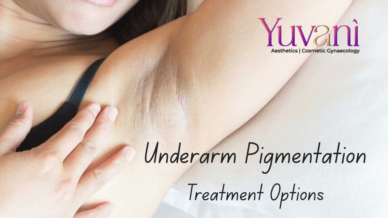Underarm Pigmentation: Causes & Treatment Options | Kharghar