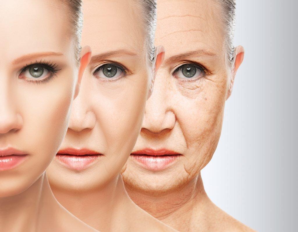 Unlocking the secrets of microneedling Radiofrequency: How it works and why its trending