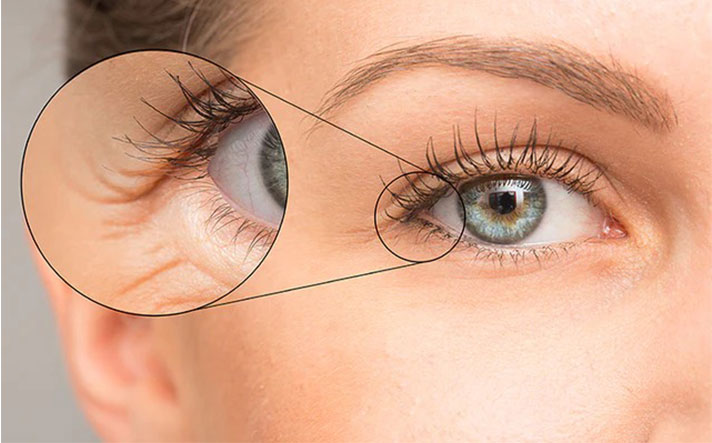 Botox treatment in Kharghar, Navi Mumbai