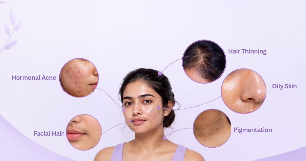 PCOD/PCOS Treatment